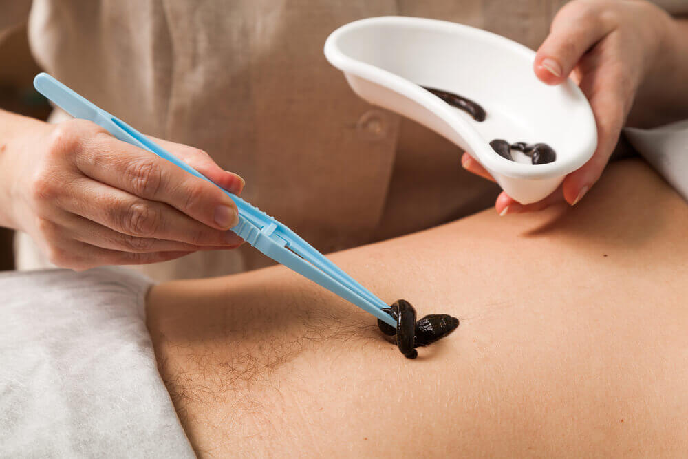 Master eCampus di I° livello Hirudoterapia: uso delle sanguisughe nella medicina moderna
